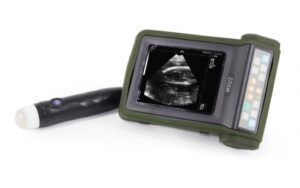 УЗИ аппарат MSU2 Kaixin