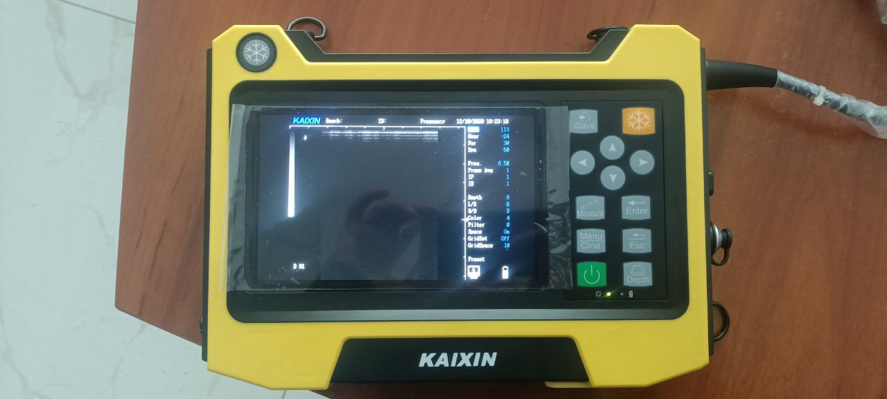 УЗИ аппарат КХ 5600Е Kaixin